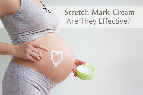 Do Stretch Mark Creams Help? Here’s What You Need To  Know