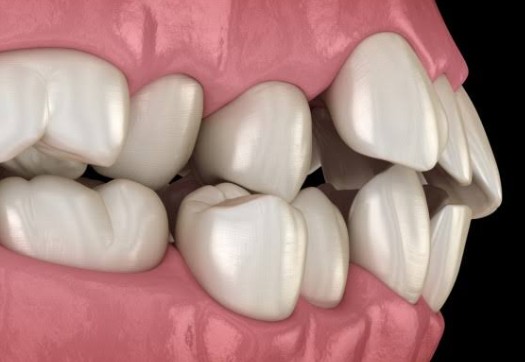 How Orthodontic Services Support Better Speech And Chewing